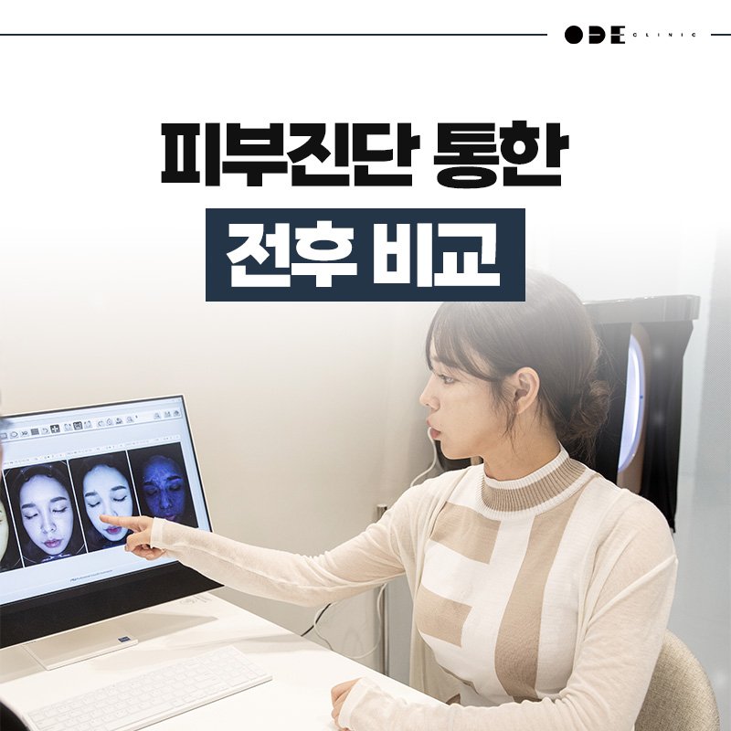 강남역 피부과 어디가 괜찮아