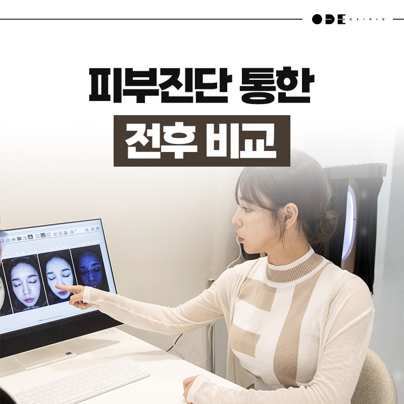 강남 스컬트라 피부과
